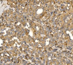 Invitrogen MLXIP Polyclonal Antibody 100 &mu;g; Unconjugated:Antibodies,