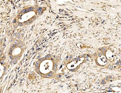 Invitrogen MLXIP Polyclonal Antibody 100 &mu;g; Unconjugated:Antibodies,