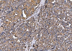 Invitrogen MLXIP Polyclonal Antibody 100 &mu;g; Unconjugated:Antibodies,