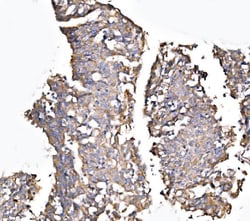Invitrogen MLXIP Polyclonal Antibody 100 &mu;g; Unconjugated:Antibodies,
