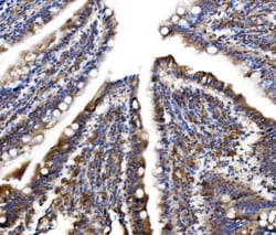 Invitrogen MLXIP Polyclonal Antibody 100 &mu;g; Unconjugated:Antibodies,