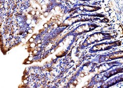 Invitrogen MLXIP Polyclonal Antibody 100 &mu;g; Unconjugated:Antibodies,
