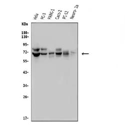 Invitrogen FRMD6 Polyclonal Antibody 100 &mu;g; Unconjugated:Antibodies,