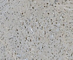 Invitrogen LSM7 Polyclonal Antibody 100 &mu;g; Unconjugated:Antibodies,