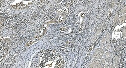 Invitrogen LSM7 Polyclonal Antibody 100 &mu;g; Unconjugated:Antibodies,