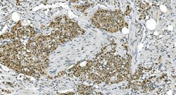 Invitrogen LSM7 Polyclonal Antibody 100 &mu;g; Unconjugated:Antibodies,