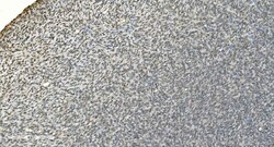 Invitrogen LSM7 Polyclonal Antibody 100 &mu;g; Unconjugated:Antibodies,