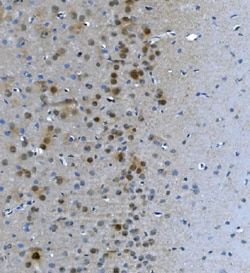 Invitrogen LSM7 Polyclonal Antibody 100 &mu;g; Unconjugated:Antibodies,