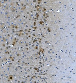 Invitrogen LSM7 Polyclonal Antibody 100 &mu;g; Unconjugated:Antibodies,
