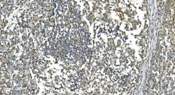 Invitrogen LSM7 Polyclonal Antibody 100 &mu;g; Unconjugated:Antibodies,