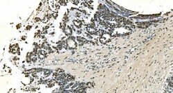 Invitrogen LSM7 Polyclonal Antibody 100 &mu;g; Unconjugated:Antibodies,