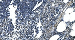 Invitrogen LSM7 Polyclonal Antibody 100 &mu;g; Unconjugated:Antibodies,