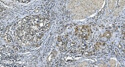 Invitrogen LSM7 Polyclonal Antibody 100 &mu;g; Unconjugated:Antibodies,