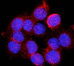 Invitrogen BDH1 Polyclonal Antibody 100 &mu;g; Unconjugated:Antibodies,