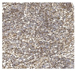 Invitrogen BDH1 Polyclonal Antibody 100 &mu;g; Unconjugated:Antibodies,