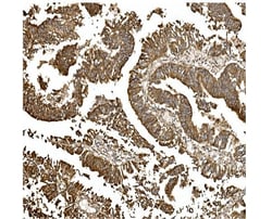 Invitrogen BDH1 Polyclonal Antibody 100 &mu;g; Unconjugated:Antibodies,