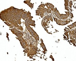 Invitrogen BDH1 Polyclonal Antibody 100 &mu;g; Unconjugated:Antibodies,