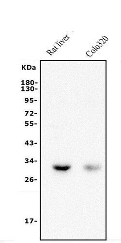 Invitrogen BDH1 Polyclonal Antibody 100 &mu;g; Unconjugated:Antibodies,