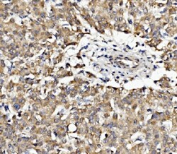 EPB41L5 Polyclonal Antibody, Invitrogen 100 &mu;g; Unconjugated:Antibodies,