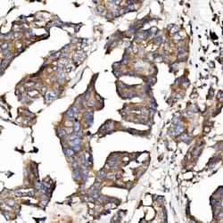 EPB41L5 Polyclonal Antibody, Invitrogen 100 &mu;g; Unconjugated:Antibodies,