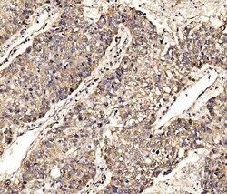 Invitrogen SCRN1 Polyclonal Antibody 100 &mu;g | Buy Online | Invitrogen&trade; | Fisher Scientific