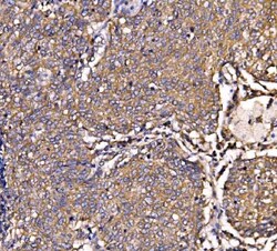 Invitrogen SCRN1 Polyclonal Antibody 100 &mu;g | Buy Online | Invitrogen&trade; | Fisher Scientific