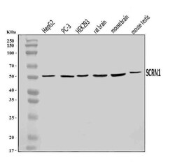 Invitrogen SCRN1 Polyclonal Antibody 100 &mu;g | Buy Online | Invitrogen&trade; | Fisher Scientific