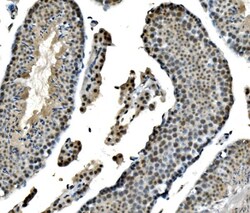 Invitrogen LSM8 Polyclonal Antibody 100 &mu;g; Unconjugated:Antibodies,