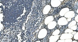 Invitrogen LSM8 Polyclonal Antibody 100 &mu;g; Unconjugated:Antibodies,