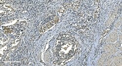 Invitrogen LSM8 Polyclonal Antibody 100 &mu;g; Unconjugated:Antibodies,