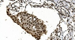 Invitrogen hnRNP H3 Polyclonal Antibody 100 &mu;g | Buy Online | Invitrogen&trade; | Fisher Scientific