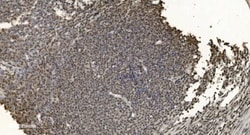 Invitrogen hnRNP H3 Polyclonal Antibody 100 &mu;g | Buy Online | Invitrogen&trade; | Fisher Scientific