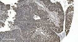 Invitrogen hnRNP H3 Polyclonal Antibody 100 &mu;g | Buy Online | Invitrogen&trade; | Fisher Scientific