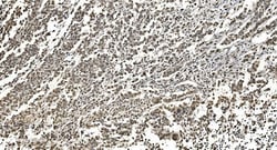 Invitrogen hnRNP H3 Polyclonal Antibody 100 &mu;g | Buy Online | Invitrogen&trade; | Fisher Scientific