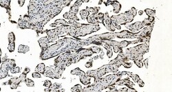 Invitrogen hnRNP H3 Polyclonal Antibody 100 &mu;g | Buy Online | Invitrogen&trade; | Fisher Scientific