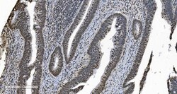 Invitrogen hnRNP H3 Polyclonal Antibody 100 &mu;g | Buy Online | Invitrogen&trade; | Fisher Scientific