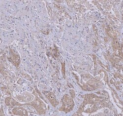 Invitrogen WDR44 Polyclonal Antibody 100 &mu;g | Buy Online | Invitrogen&trade; | Fisher Scientific