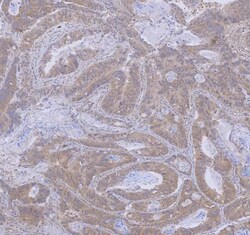 Invitrogen WDR44 Polyclonal Antibody 100 &mu;g | Buy Online | Invitrogen&trade; | Fisher Scientific
