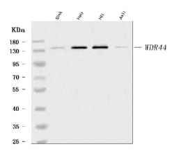 Invitrogen WDR44 Polyclonal Antibody 100 &mu;g | Buy Online | Invitrogen&trade; | Fisher Scientific