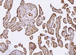 Invitrogen PKIB Polyclonal Antibody 100 &mu;g; Unconjugated:Antibodies,
