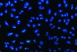 Invitrogen WDR3 Polyclonal Antibody 100 μg; Unconjugated:Antibodies,
