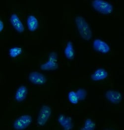 Invitrogen TOX2 Polyclonal Antibody 100 &mu;g; Unconjugated:Antibodies,