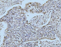 Invitrogen SBNO1 Polyclonal Antibody 100 &mu;g; Unconjugated:Antibodies,