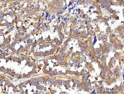 Invitrogen CCDC115 Polyclonal Antibody 100 μg; Unconjugated:Antibodies,