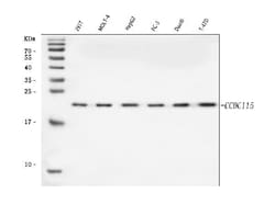 Invitrogen CCDC115 Polyclonal Antibody 100 μg; Unconjugated:Antibodies,