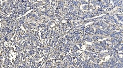 Invitrogen HYI Polyclonal Antibody 100 &mu;g; Unconjugated:Antibodies,