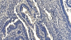 Invitrogen HYI Polyclonal Antibody 100 &mu;g; Unconjugated:Antibodies,
