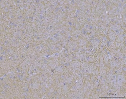 Invitrogen WDR7 Polyclonal Antibody 100 &mu;g; Unconjugated:Antibodies,