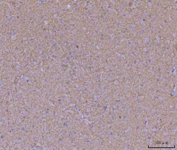 Invitrogen WDR7 Polyclonal Antibody 100 &mu;g; Unconjugated:Antibodies,