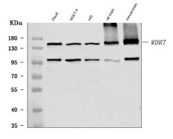 Invitrogen WDR7 Polyclonal Antibody 100 &mu;g; Unconjugated:Antibodies,